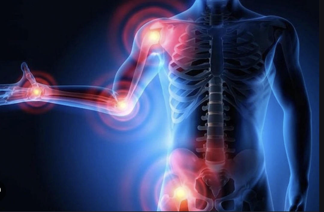 Anti Inflammatory Diet & Lifestyle incl Supplements